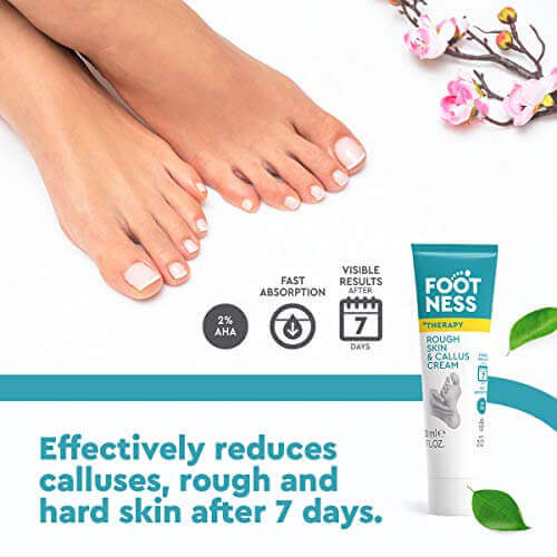 Rough Skin & Callus Cream 30G