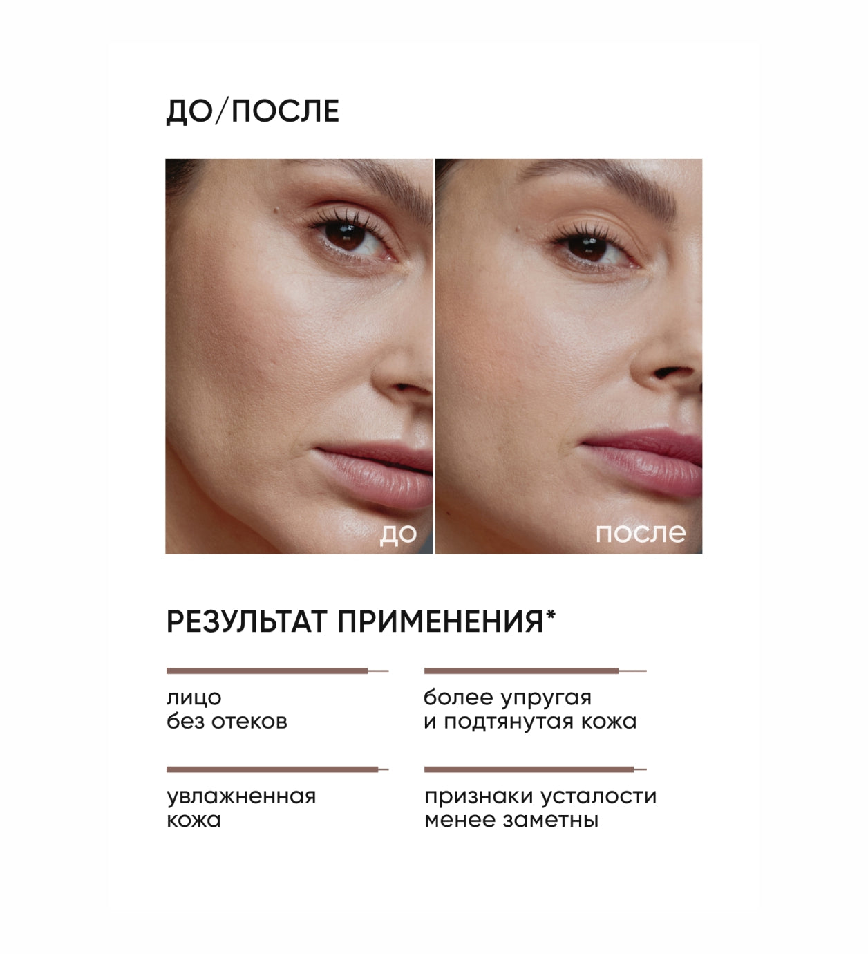 Icon Skin Skin Gym Lymphatic Drainage Tonic 150 ml