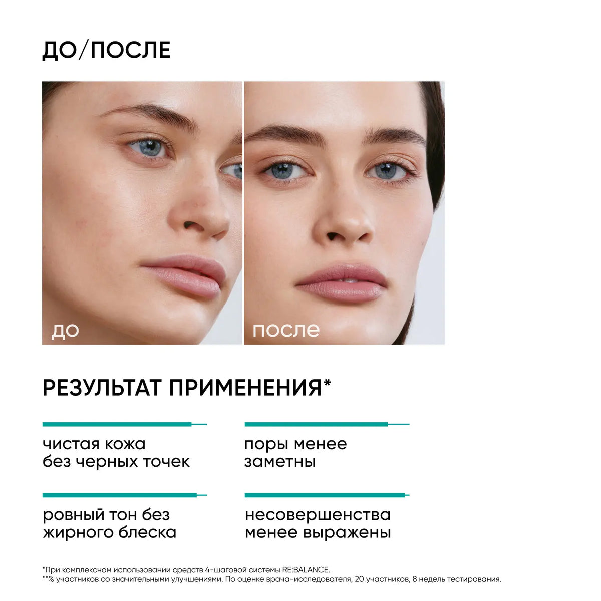 Icon Skin Serum with salicylic acid Pore Reformer / Pore Reformer Salicylic Serum, 30 ml